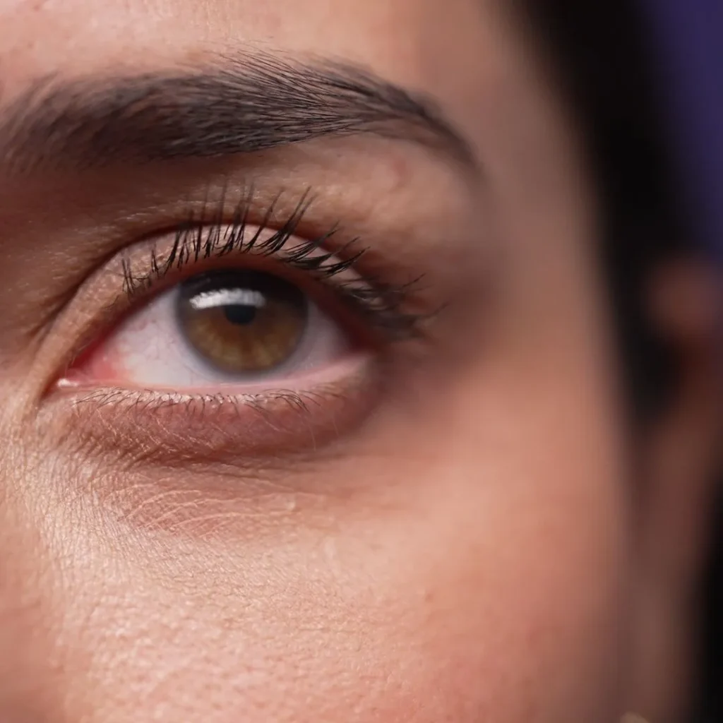 Retina specialist in Dubai and Abu Dhabi​ (120)