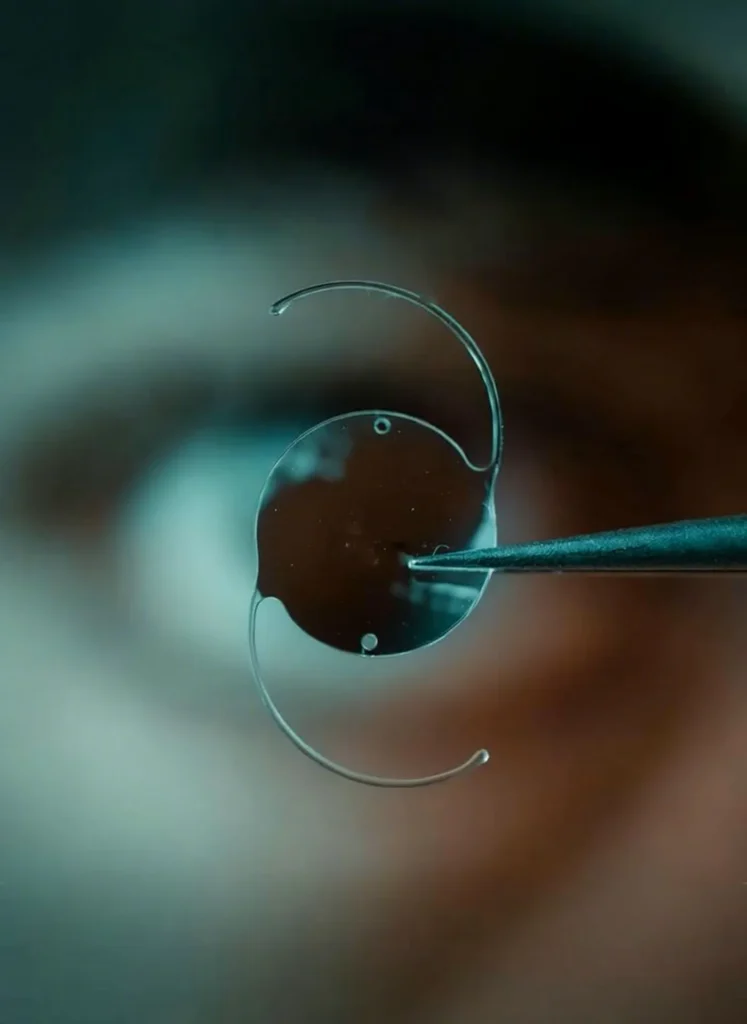 Dr. Hassan A. Aziz - Ophthalmologist in Dubai and Abu Dhabi - Ophthalmologist in Abu Dhabi